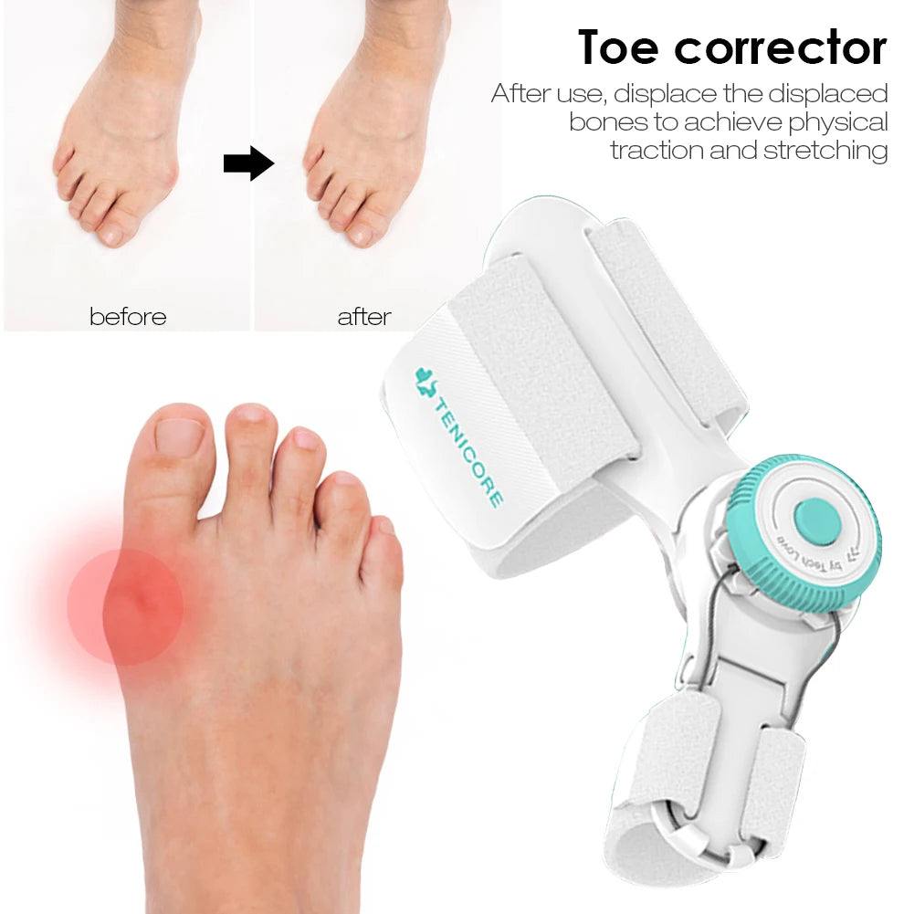Upgraded Toe Bunion Corrector - 3D Knob Toes Corrector