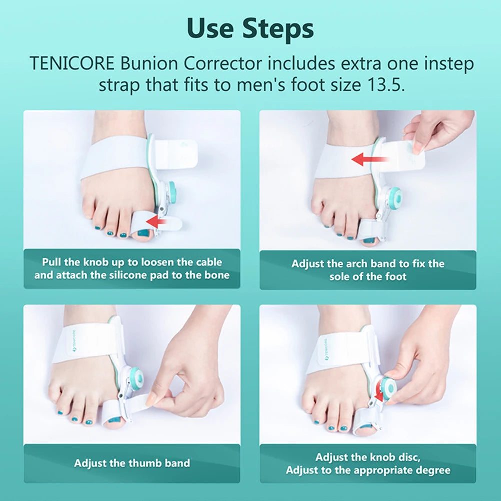 Upgraded Toe Bunion Corrector - 3D Knob Toes Corrector